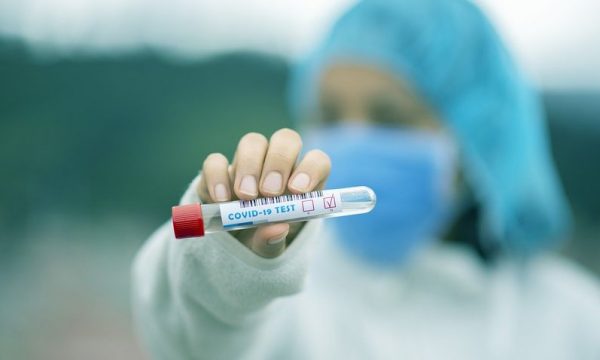 Coronavirus-19 - test Coronavirus-19 - test